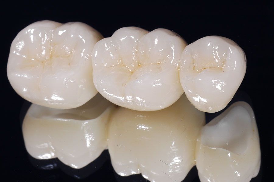 ортопедия и восстановление зубов муром дионисдент