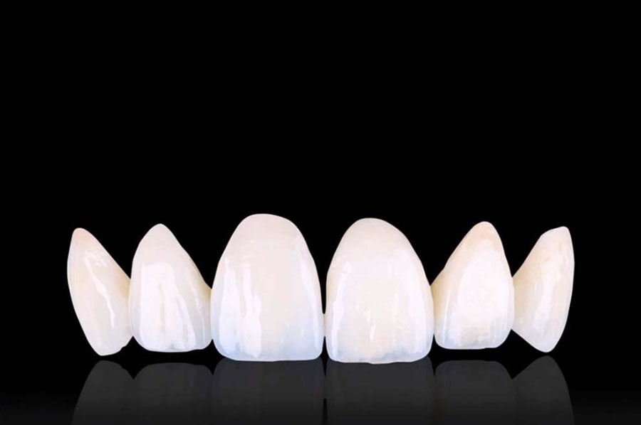 ортопедия и восстановление зубов муром дионис дент