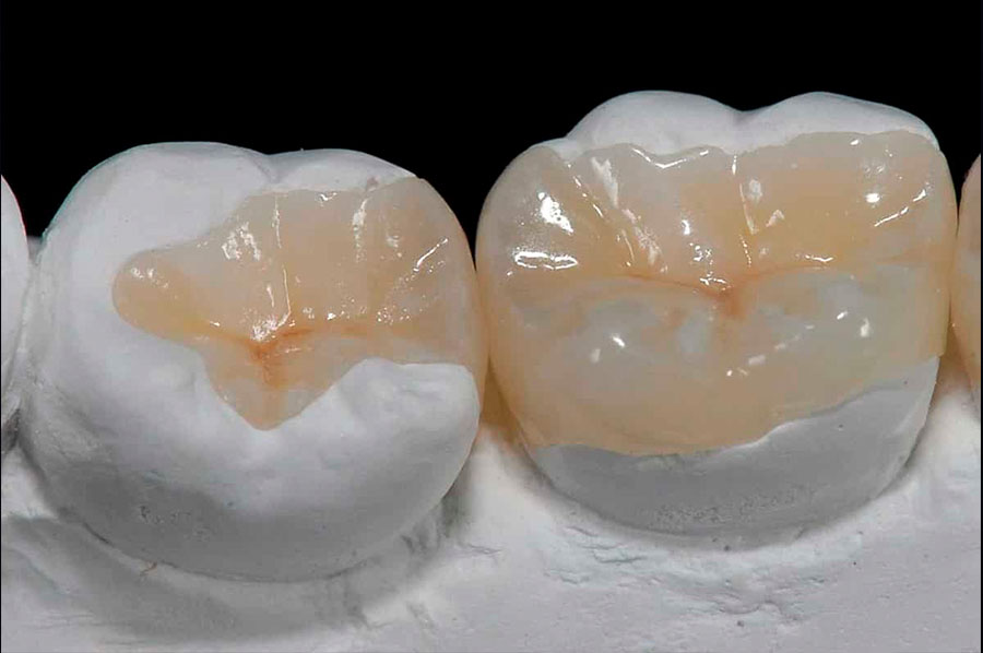ортопедия и восстановление зубов муром дионис дент